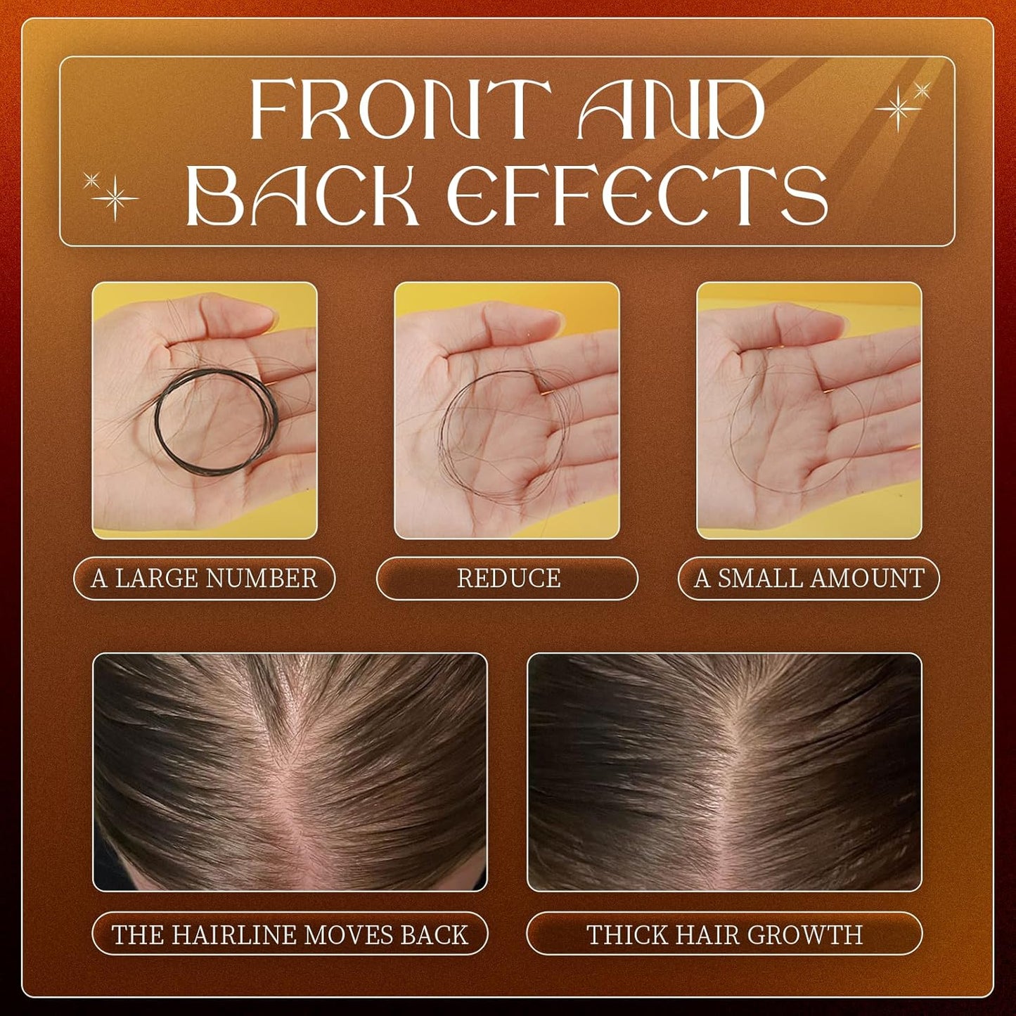 Rootify™ Anti-Hair Fall Shampoo